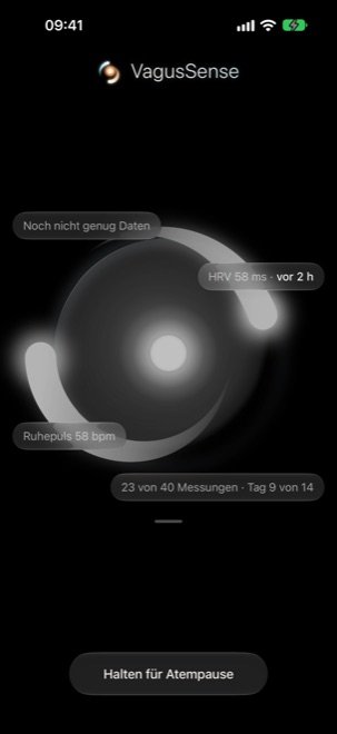 The iPhone screen during the cold start: instead of a state it shows the raw values and the progress of the first two weeks.